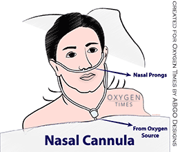 Patient with Nasal Cannula